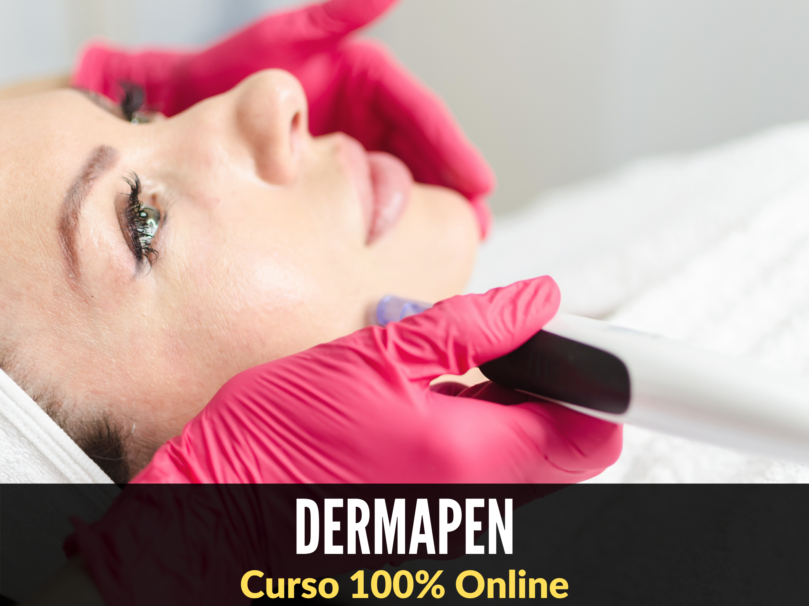Dermapen Microneedling con Yess Lacroix