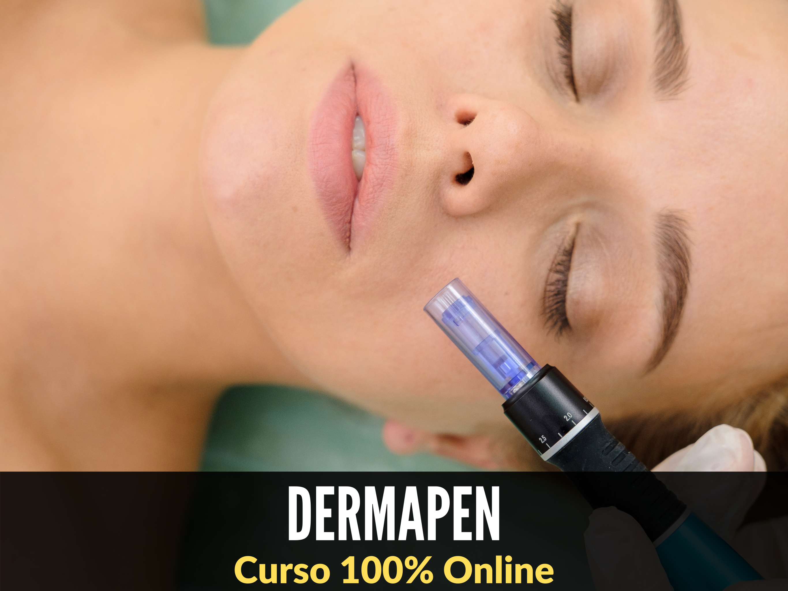 Dermapen Microneedling con Yess Lacroix