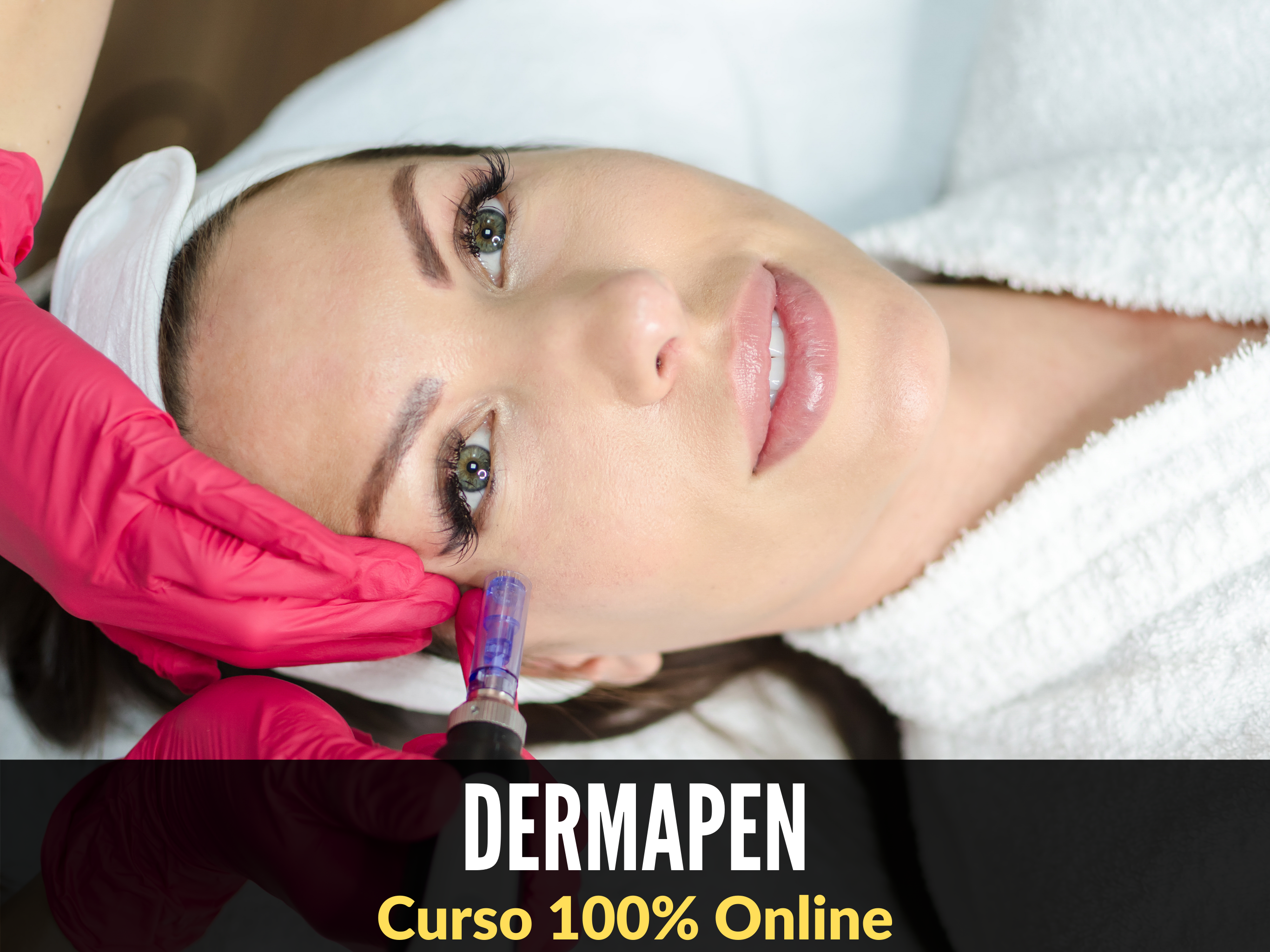 Dermapen Microneedling con Yess Lacroix