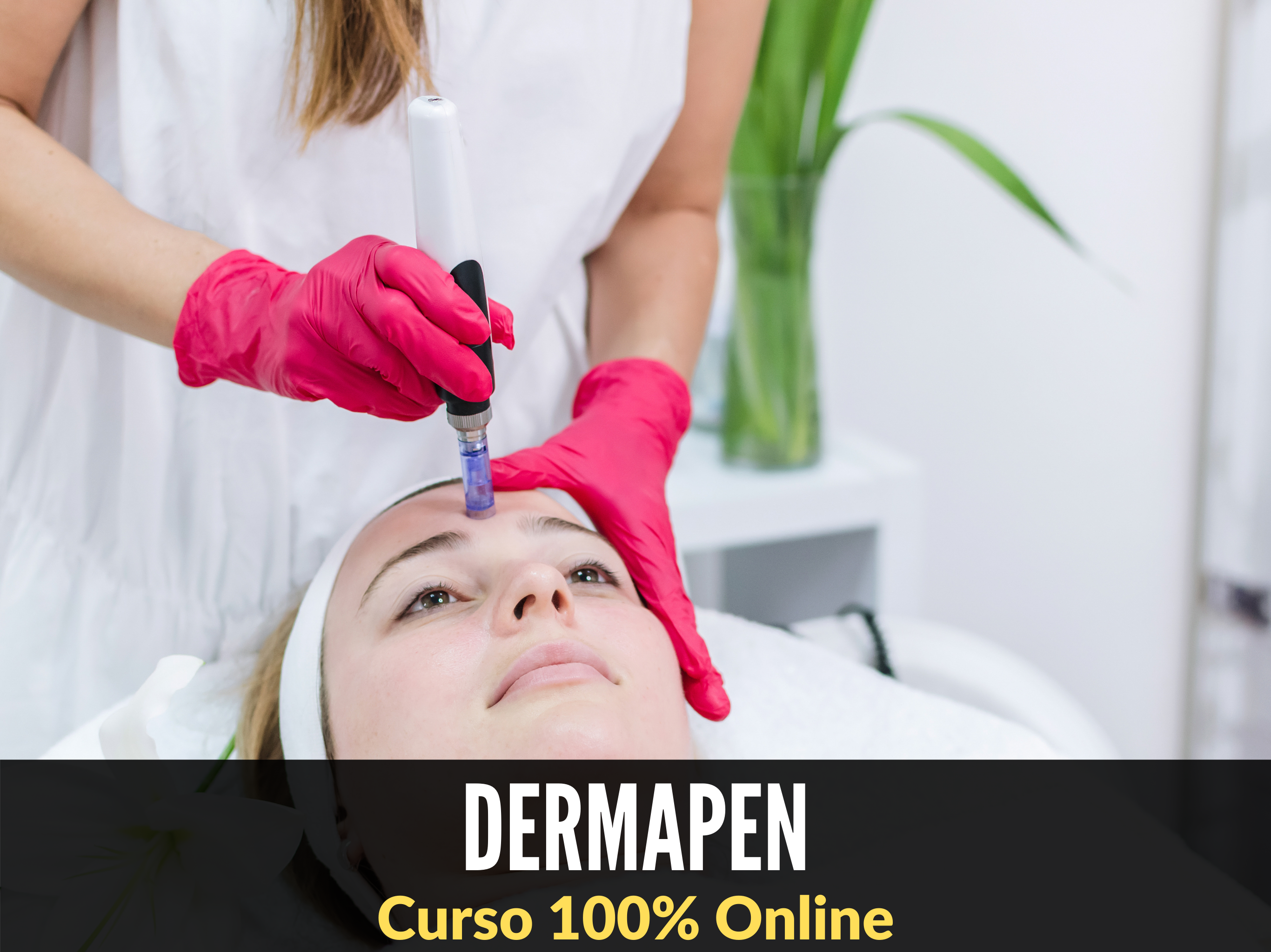 Dermapen Microneedling con Yess Lacroix