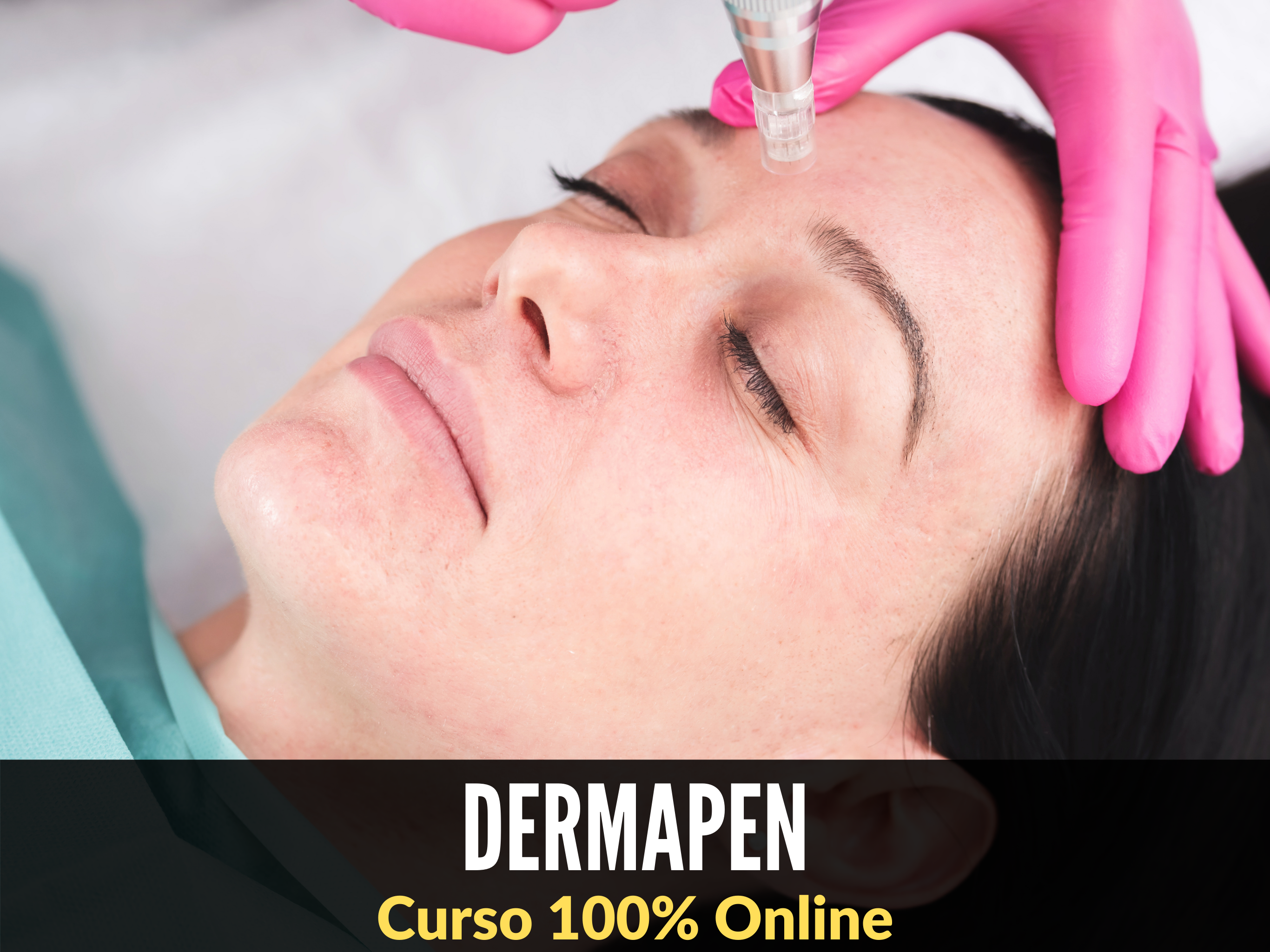 Dermapen Microneedling con Yess Lacroix