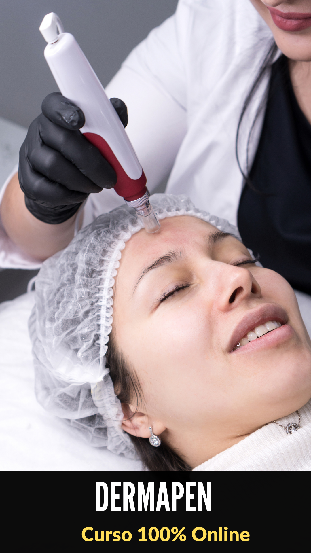 Dermapen Microneedling con Yess Lacroix